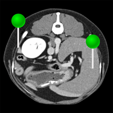 Abdomen und Beckenanatomie des Rüden im CT mit Stiften