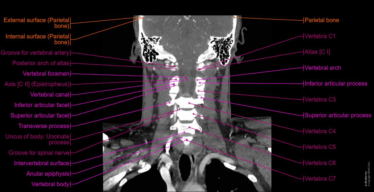 CT scan of head and neck: normal anatomy | e-Anatomy