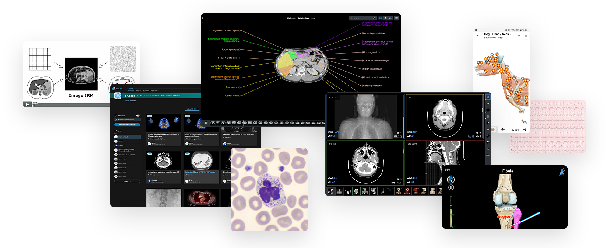 Anatomy, medical imaging and e-learning for healthcare professionals ...