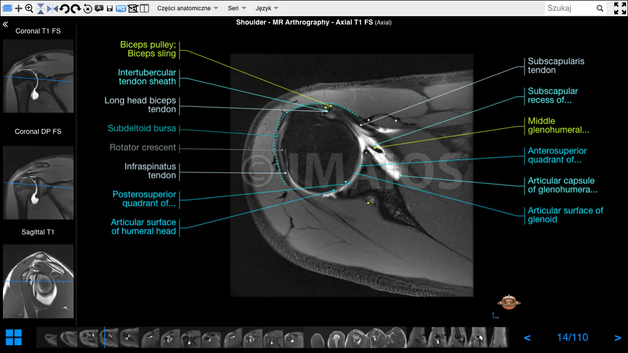 Shoulder MR Arthrogram | e-Anatomy