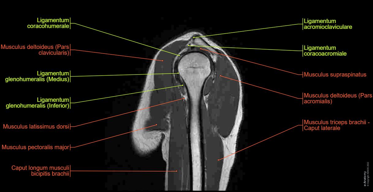 MRT Der Schulter Normale Anatomie E Anatomy mrt-der-schulter-normale-anatomie-e-anatomy